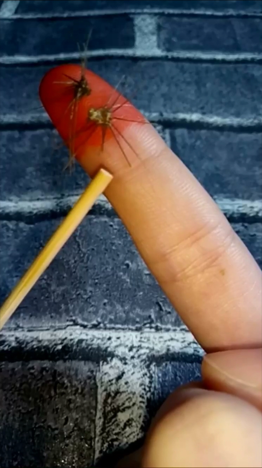 手指扎刺这样做,刺就会自己跑出来