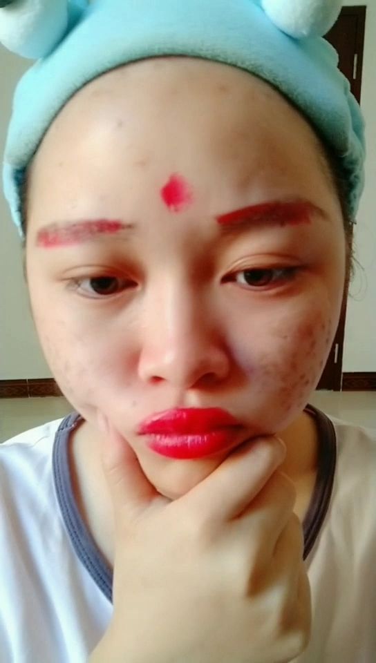 早上起来脸上长了好多麻子060606