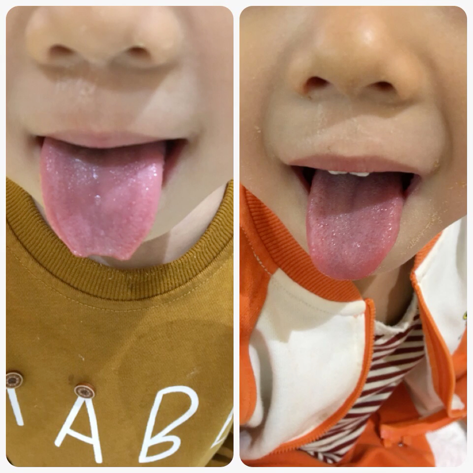 刚来时无舌苔&现在的舌苔,对比一下真的很明显呢949494
