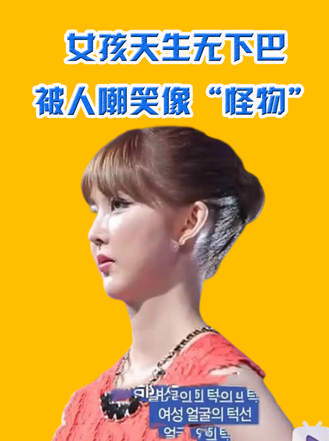 女孩天生无下巴,被人嘲笑长得像"怪物",节目免费整容后直接成明星脸