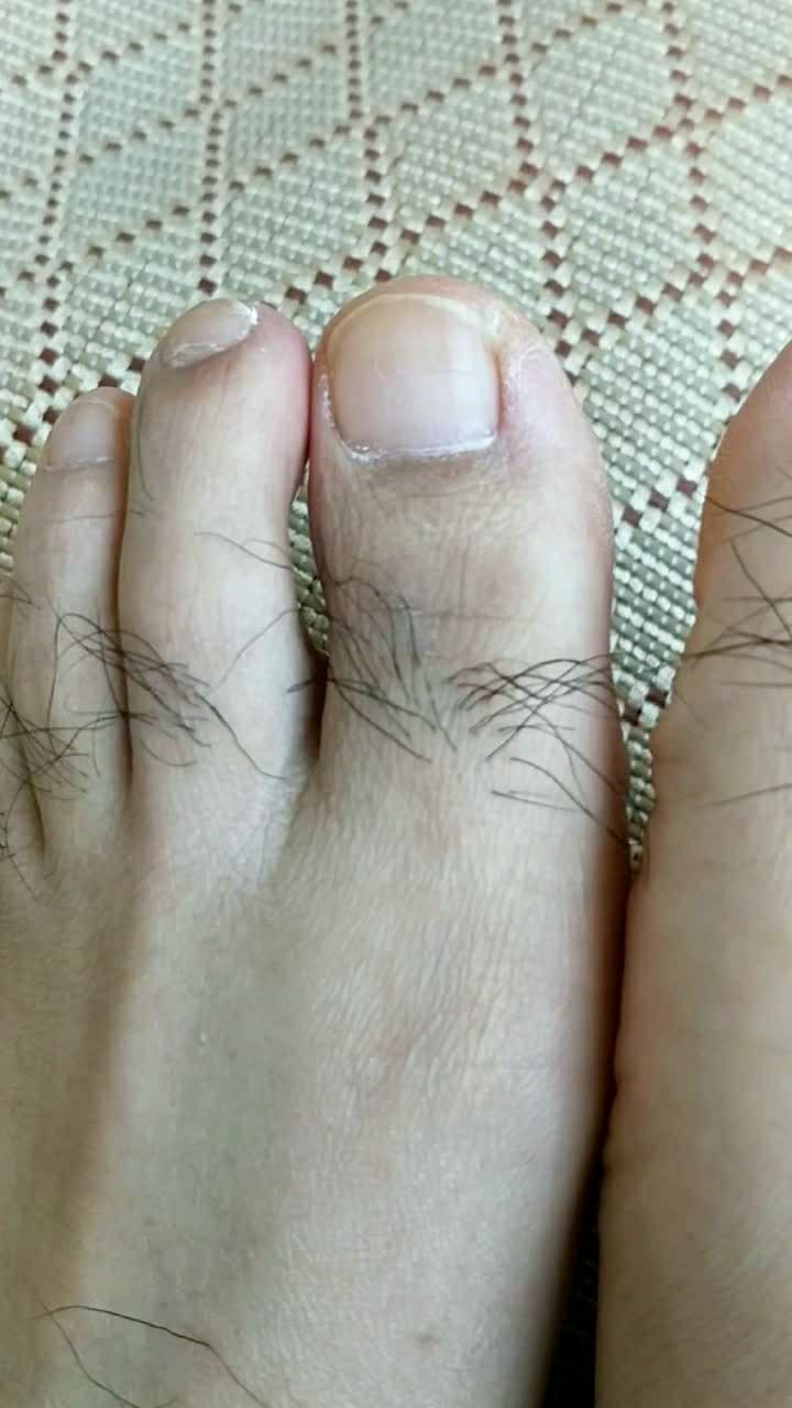还有谁有这么长的脚趾毛……97