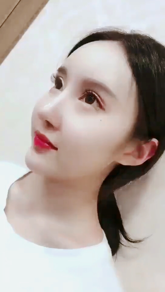 美女做的自体脂肪填充 鼻综合  元宝下巴 3个月了 美吗