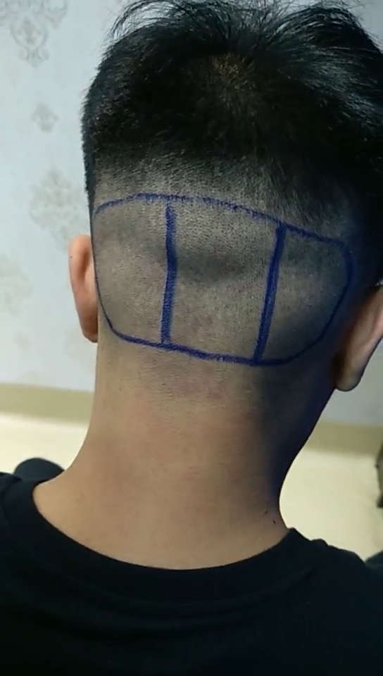 丰富的后枕部资源