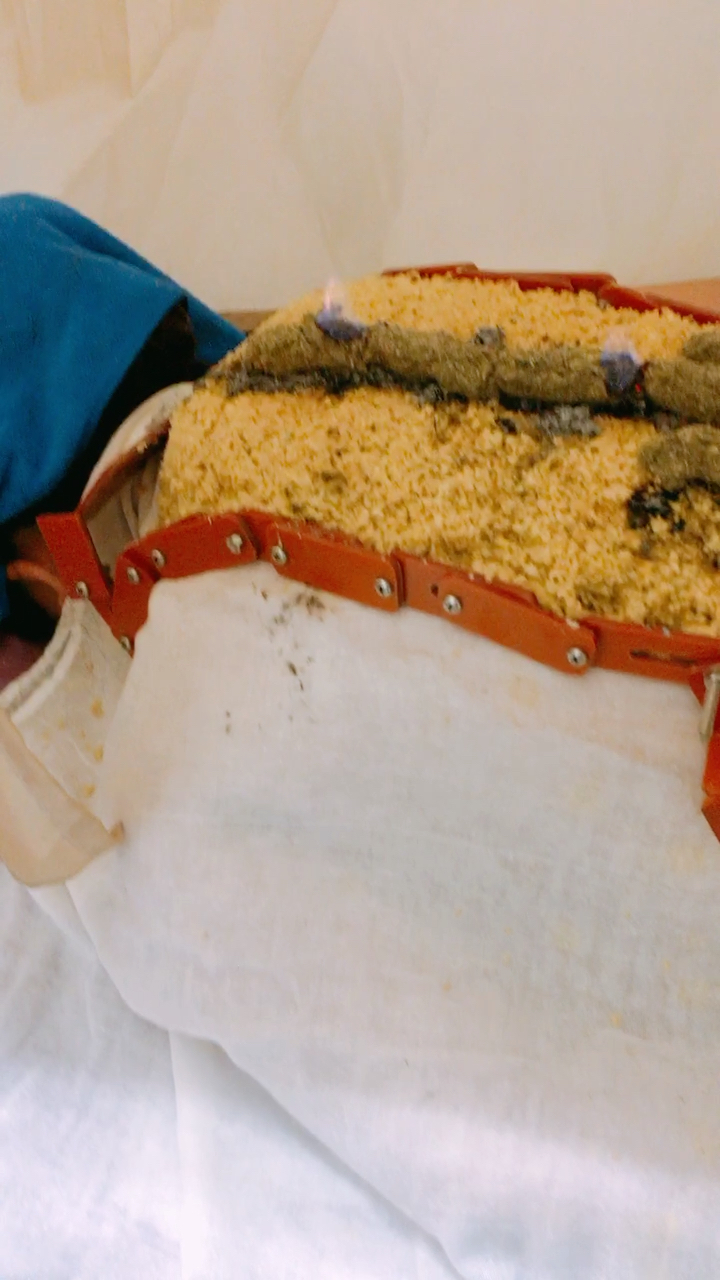 黄老师古法督脉长龙灸走起