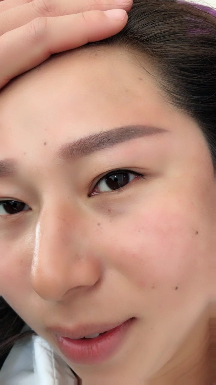 刚结完痂皮的眉毛