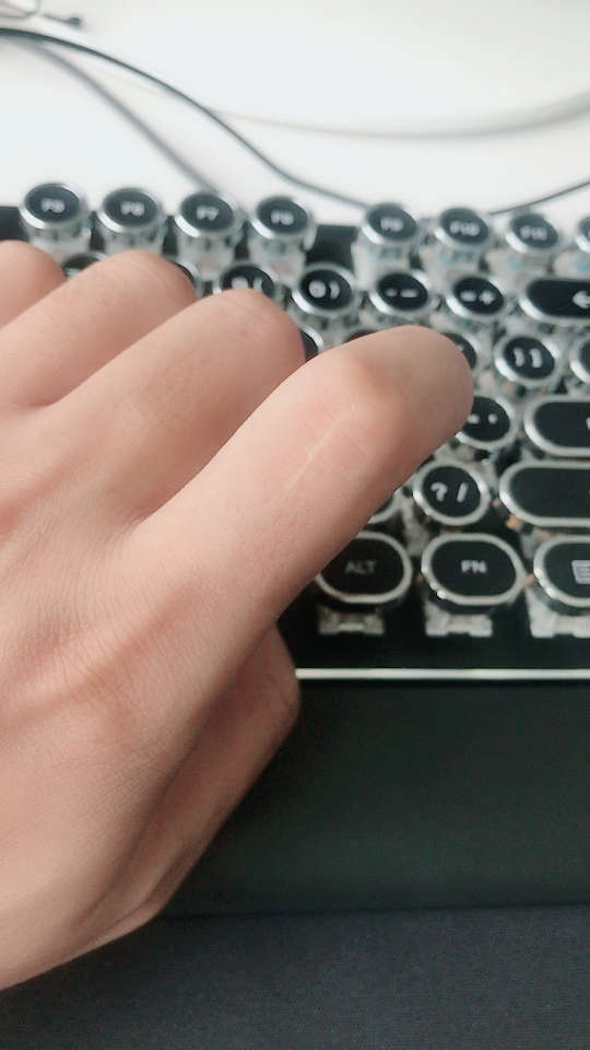 听说左手手指有伤疤的人都是上辈子情人留下来的痕迹,求上辈子的你