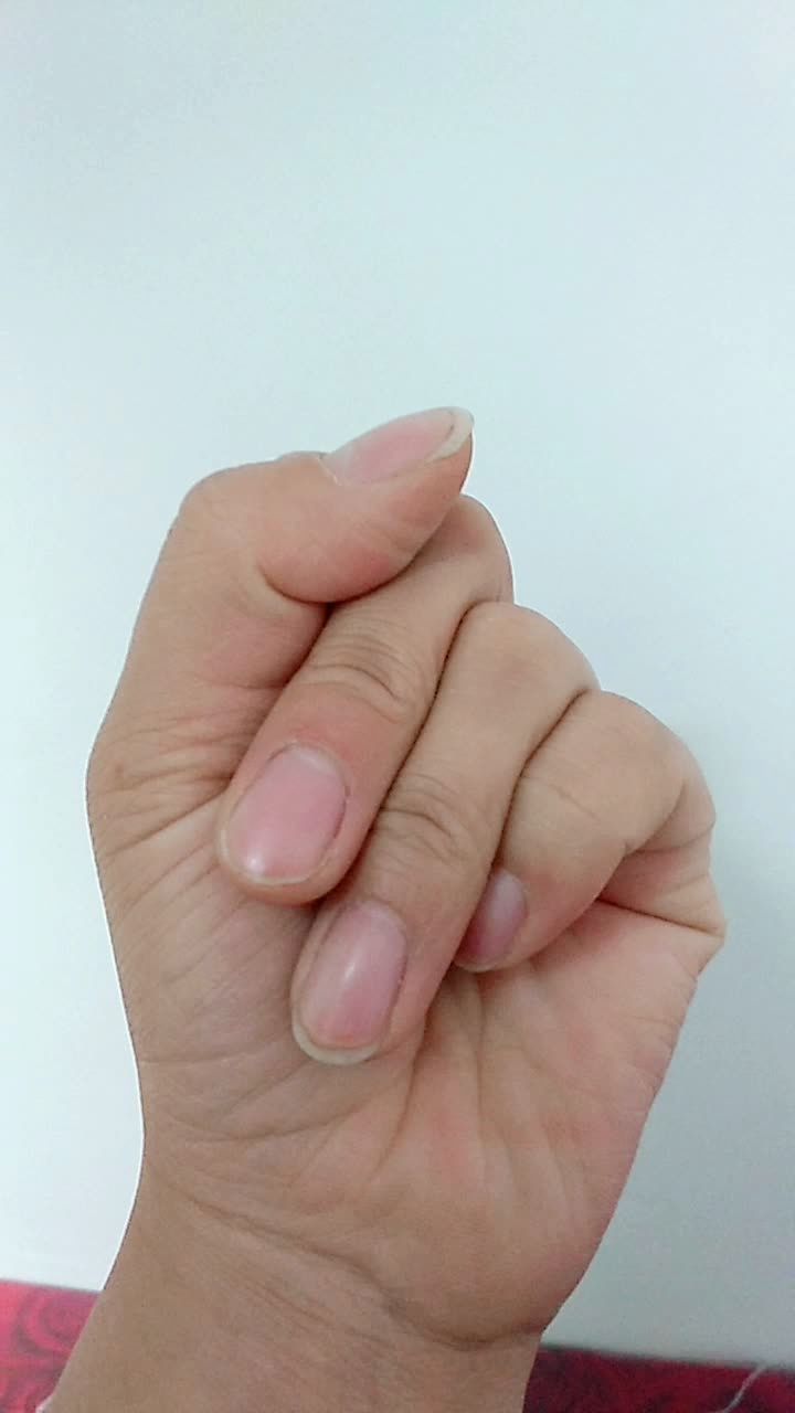 左手天生四个手指