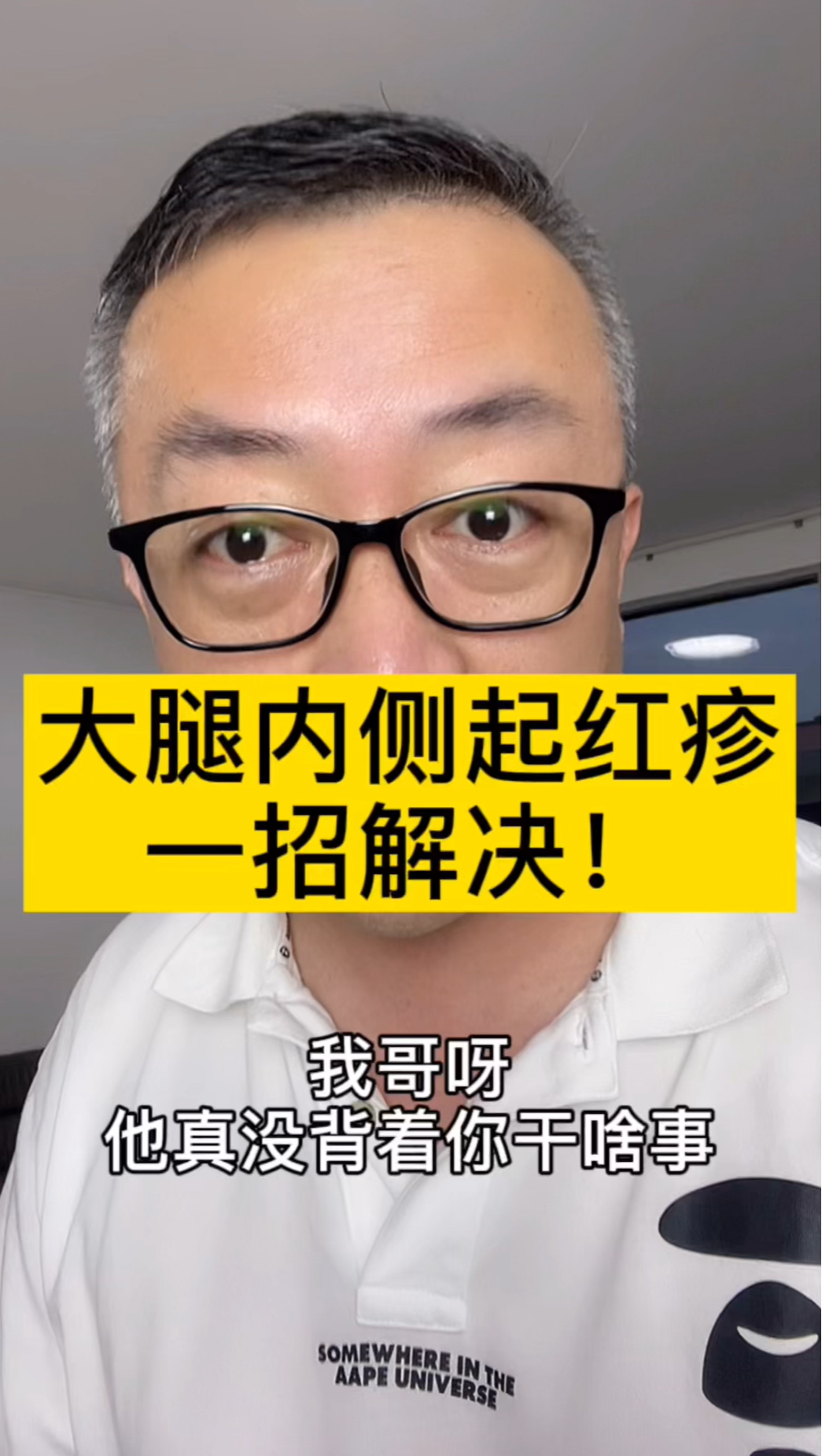 大腿内侧起红疹,还特别痒,千万别抓挠,这是股癣,真菌感染引起来的,试