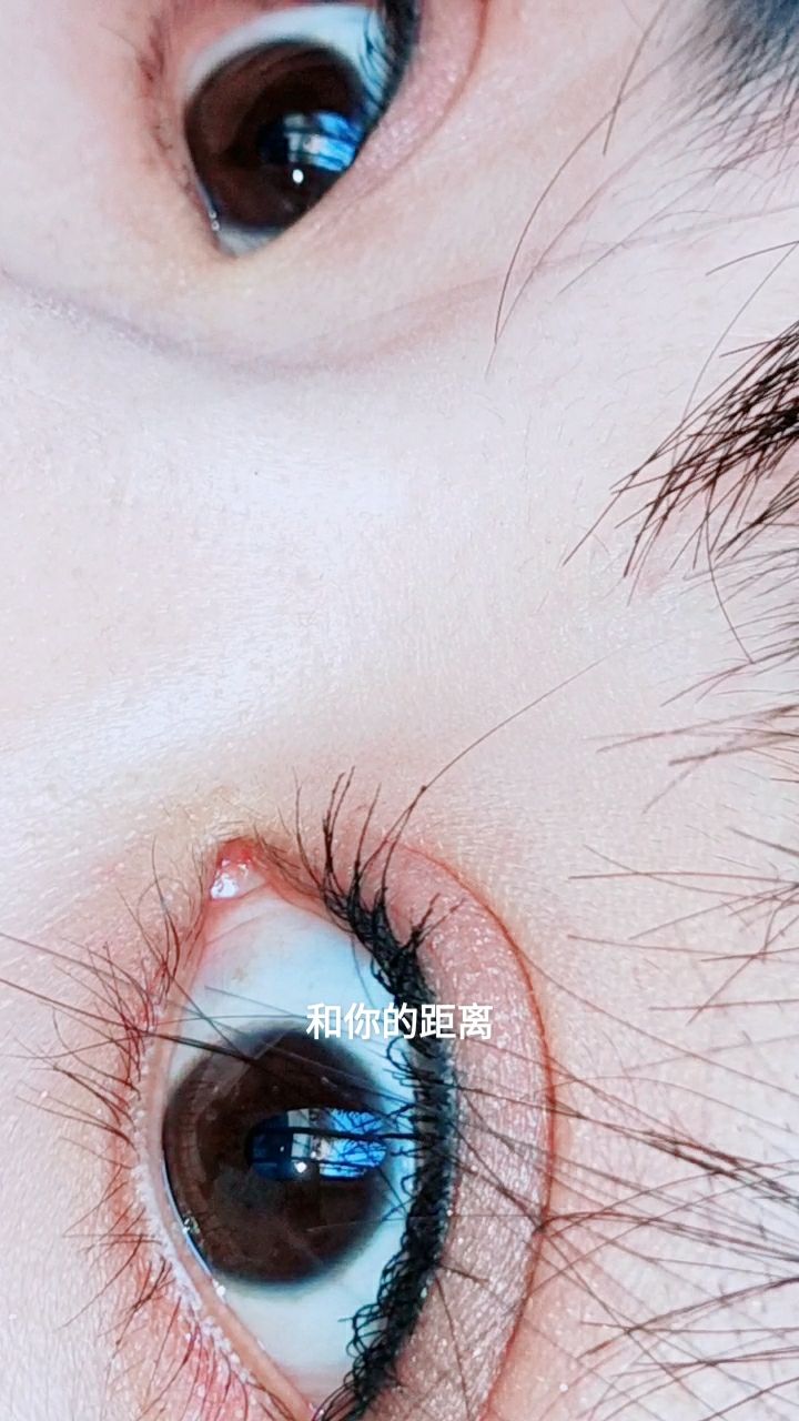 左睫剪掉睫毛20天后长出的效果,来二只眼睛对比,打上睫毛膏胜过嫁接
