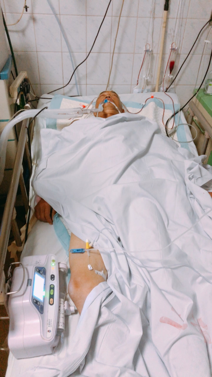 我的父亲在医院昏迷不醒  说是脑干出血不知道能不能醒来  希望大家能