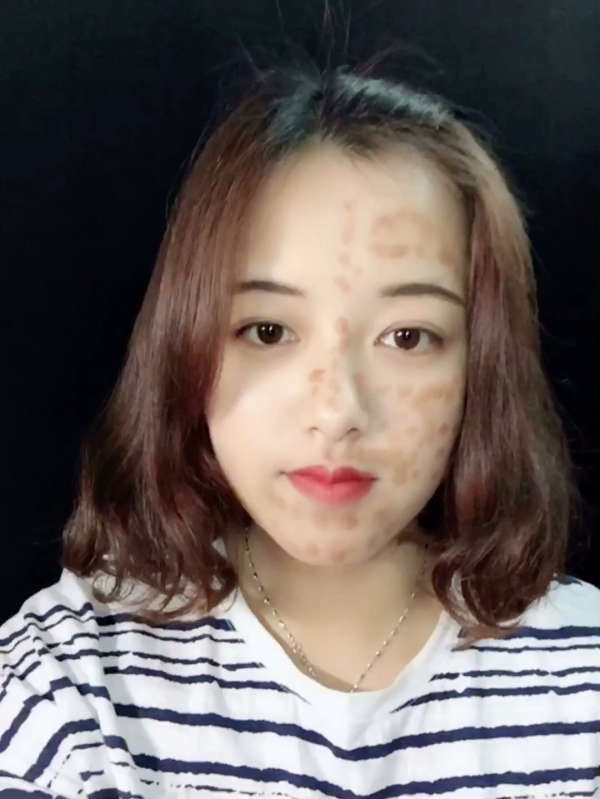 9515脸麻子又如何!
