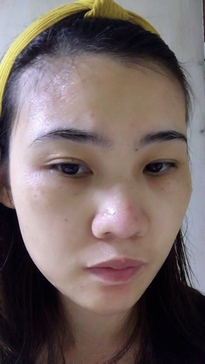 二十天前还是满脸斑,暗沉,干燥,连自己都嫌弃,更别提老公了