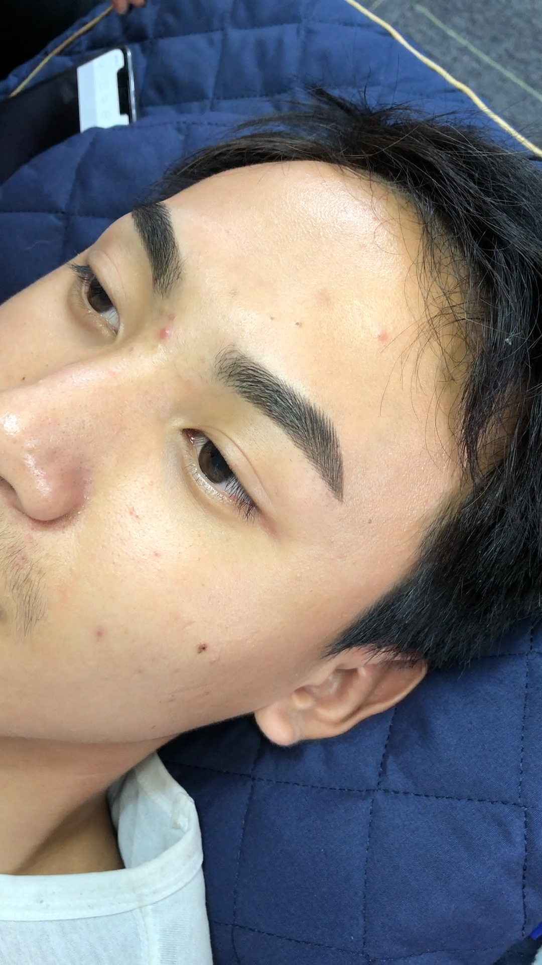 男士纹眉 恢复期图片