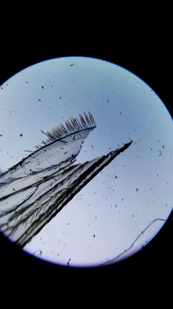 显微镜下解刨蚊子,场面震撼