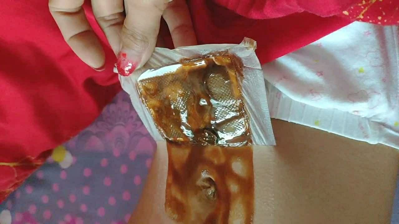 孩子肚子不舒服,看排出来这湿气