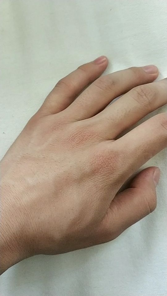 手背与手心,同是一只手,但是差距真的很大.不要被外表所迷惑