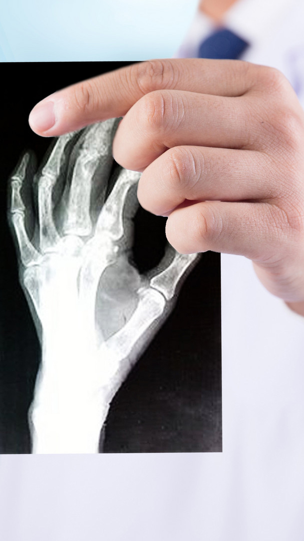 手机秒变ct透视扫描仪,连你手上的"骨骼"纹路都可以看见