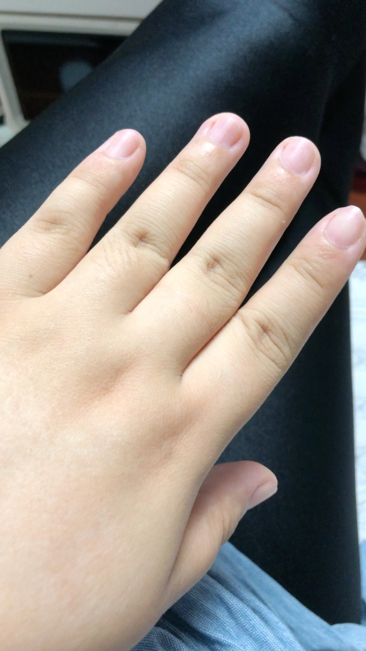 你左手手指上有疤么?