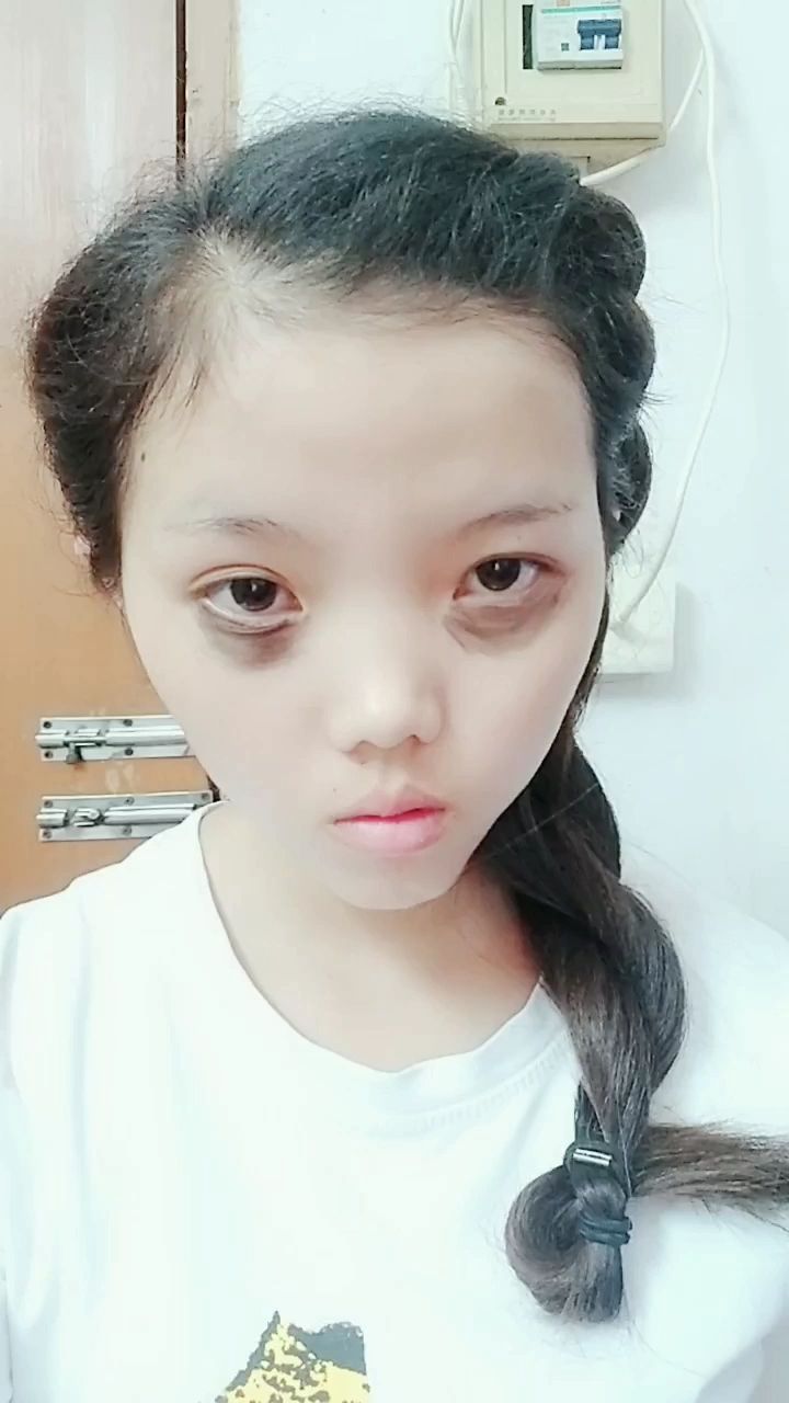 熬夜三个月成熊猫眼,知道为啥吗进来就知道情况