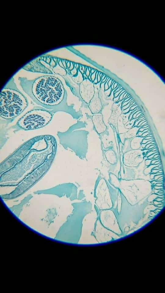 微观之蛔虫切片