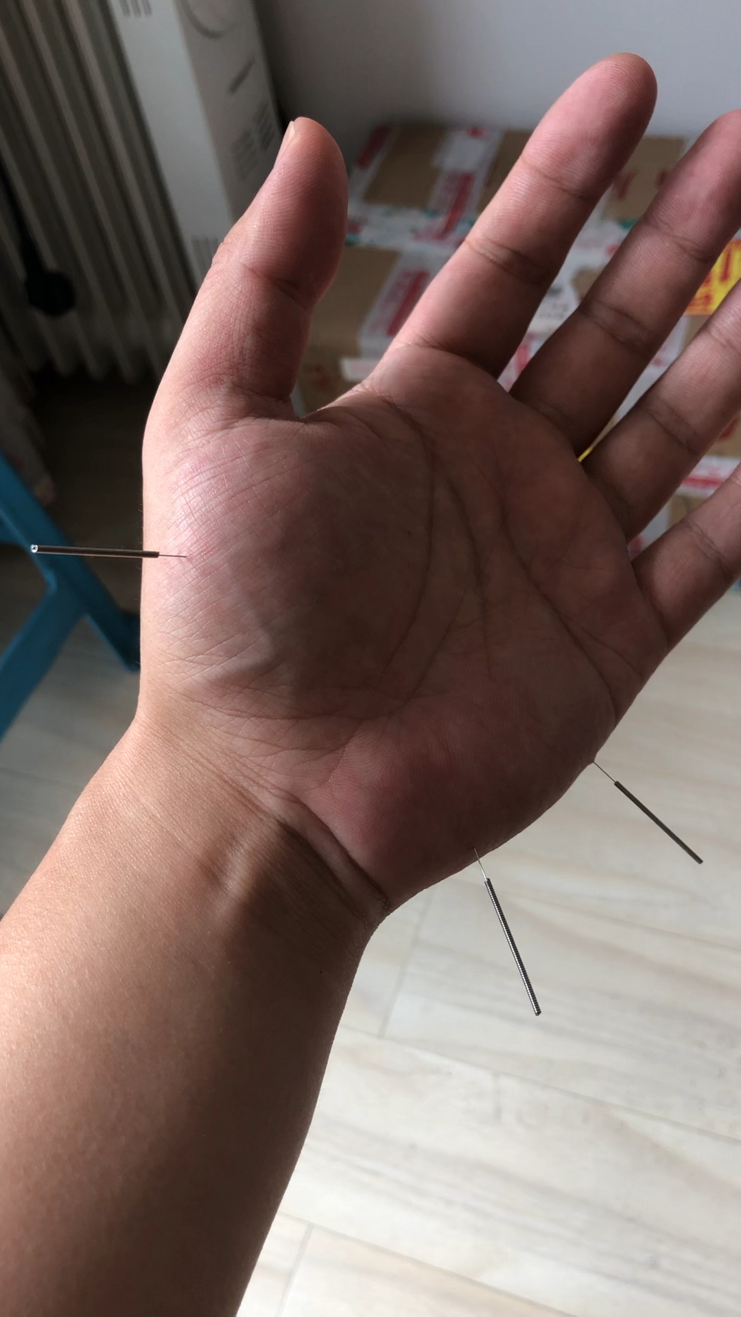 太极六合针法,每天自己扎自己体验针感!欲成大医,必先自己体验!