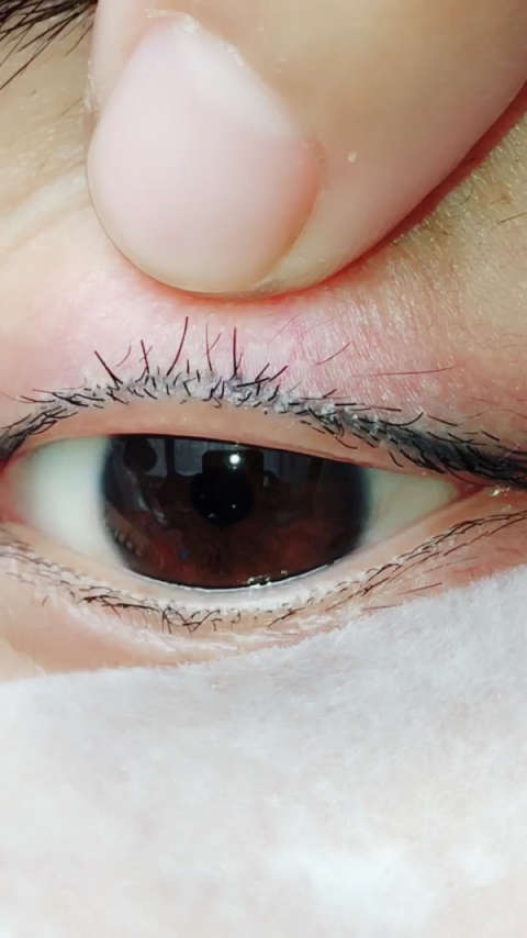 剪掉睫毛第九天,喜欢长睫毛的朋友双击关注看每天的变化,感谢支持05