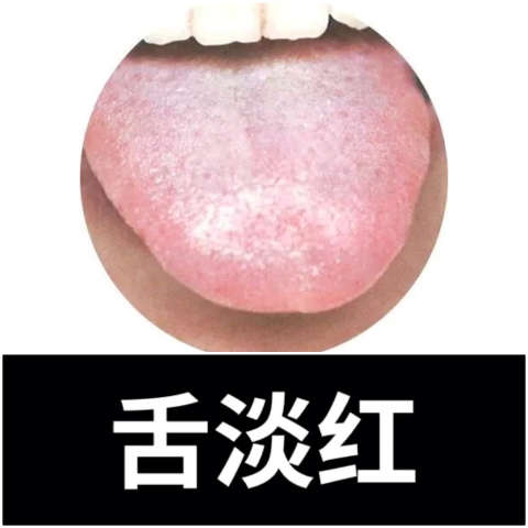 舌相分析:舌淡红93苔薄白 治法:补脾益气,固冲调经