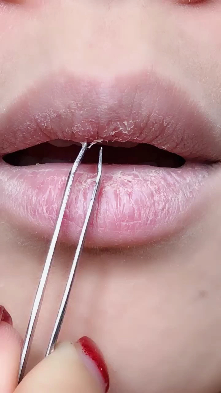 秋冬季 你是否为嘴巴起皮干裂忧虑.