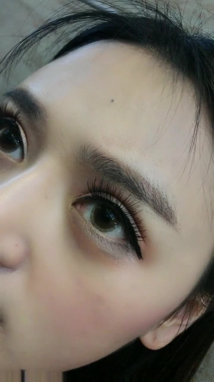 欧式芭比眼综合第28天