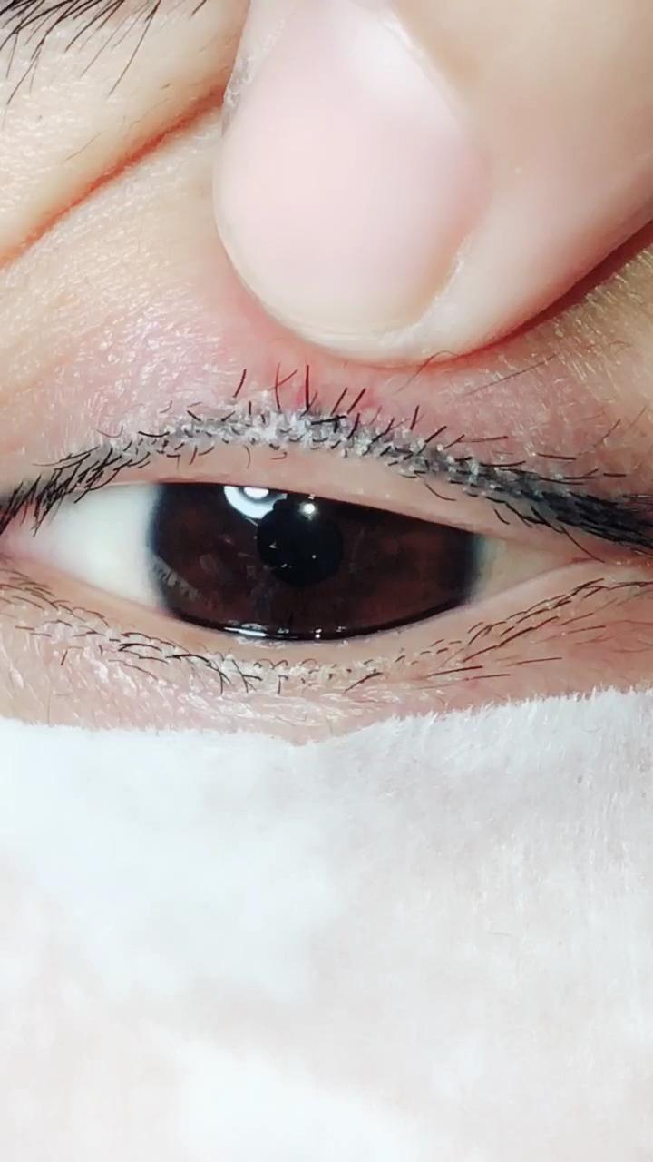 剪掉睫毛第五天,喜欢长睫毛的朋友双击关注看每天的变化,感谢支持05