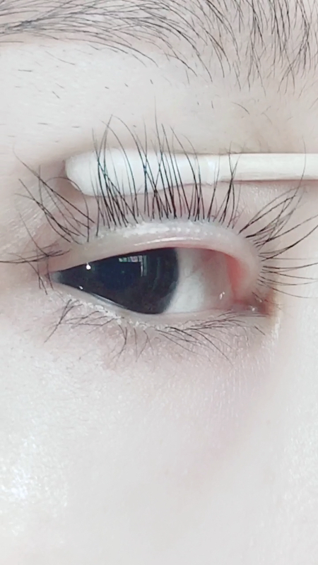 我把眼皮掰起来你们好好看看我的睫毛根部,都是自己生长的睫毛,我只是