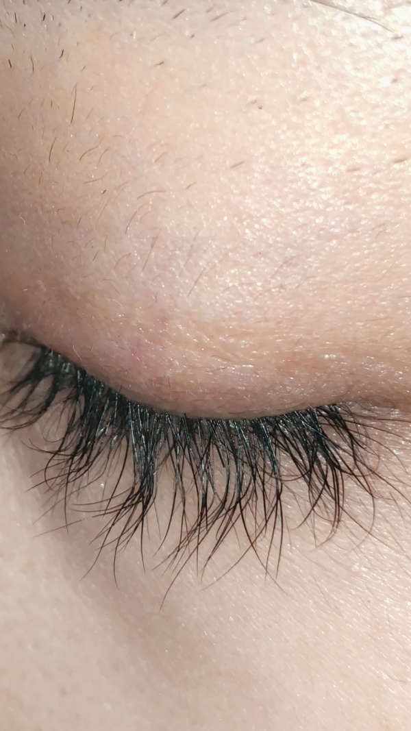 滋养毛囊 让睫毛二次生长7099