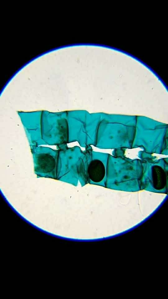 微观之水绵接合生殖装片