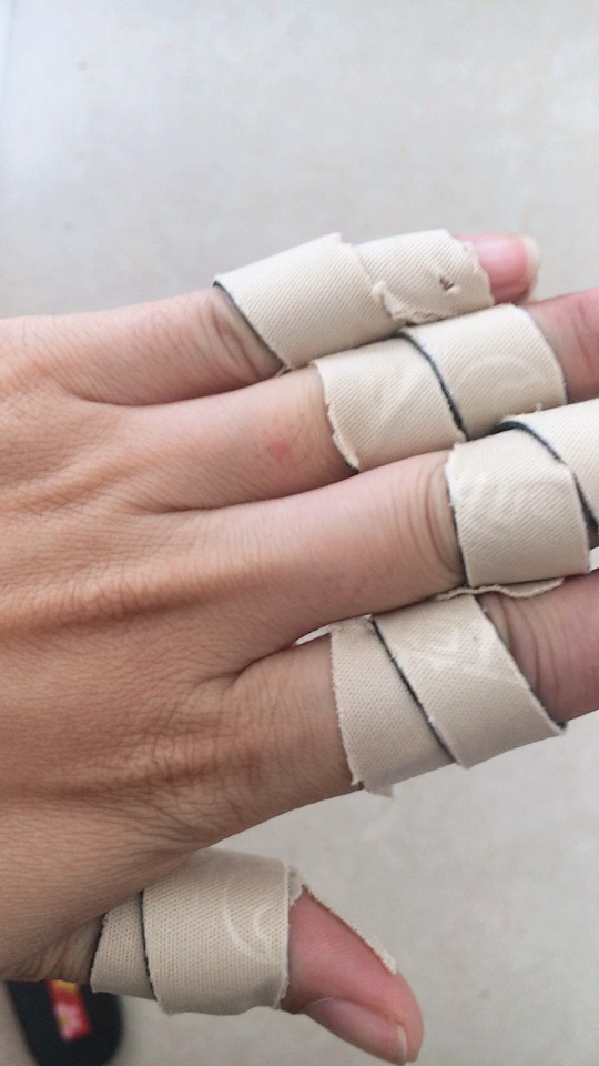 风湿类手指关节痛,严重变形的可以这样