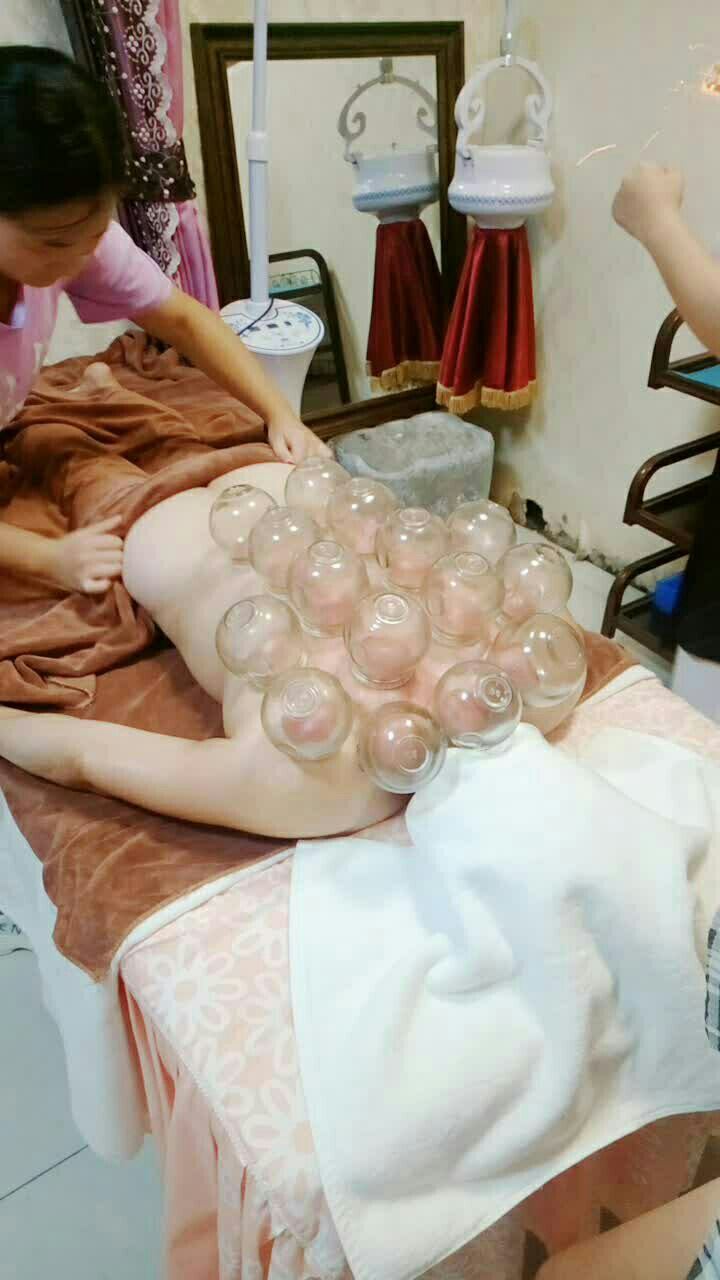 77幸福卡乐不停,养生拔罐了解一下070707