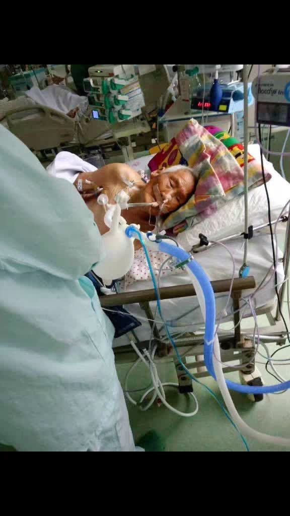 八十多岁老人心脏衰竭,住进重症监护室每天一万多