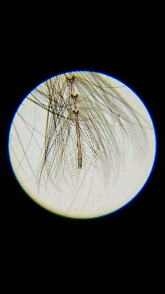 微观之蚊子口器装片