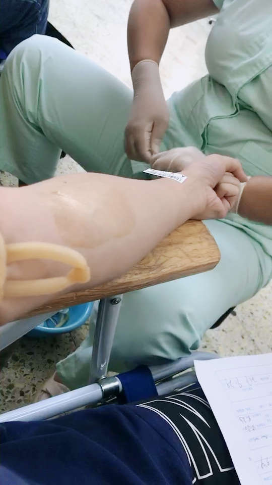 第一次献血,那么粗的针头,医生说我血管太细,比这针头粗不了多少…200