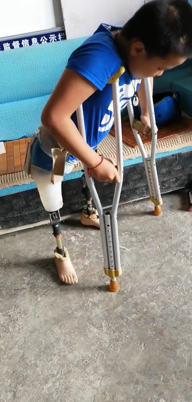 用假肢走路