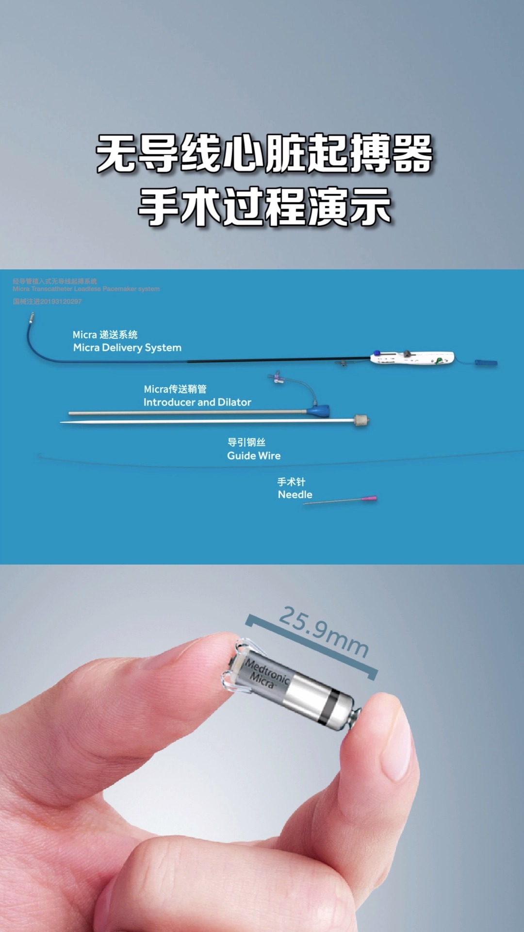 你知道无线起搏器是怎么植入人体心脏的吗?