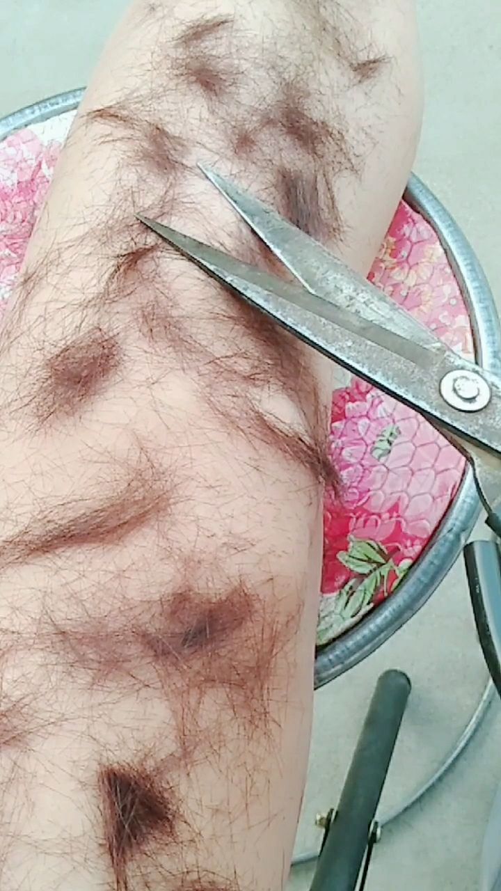 腿毛太长用剪刀剪掉