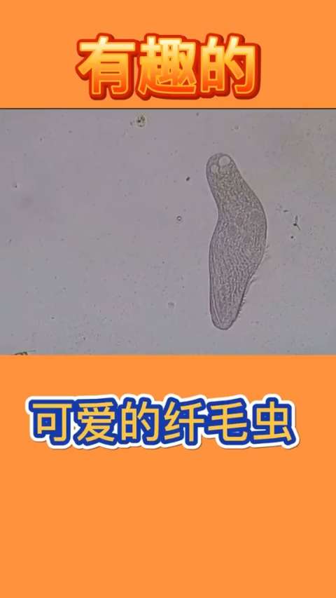 显微镜下的大世界,给你看看可爱的纤毛虫!