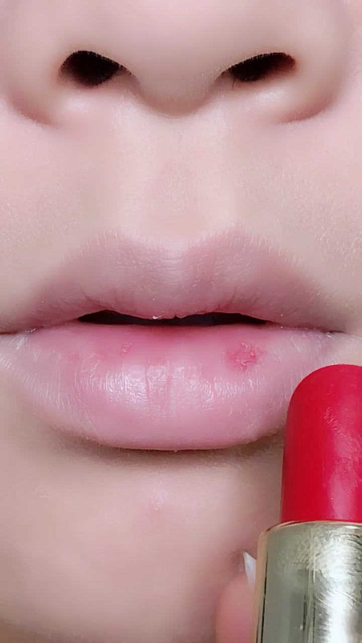 嘴巴破了,依旧拍视频,全力支持微视平台