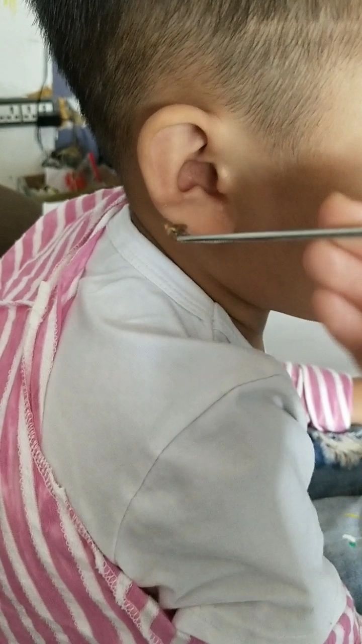 小朋友的耳朵,堵满了.