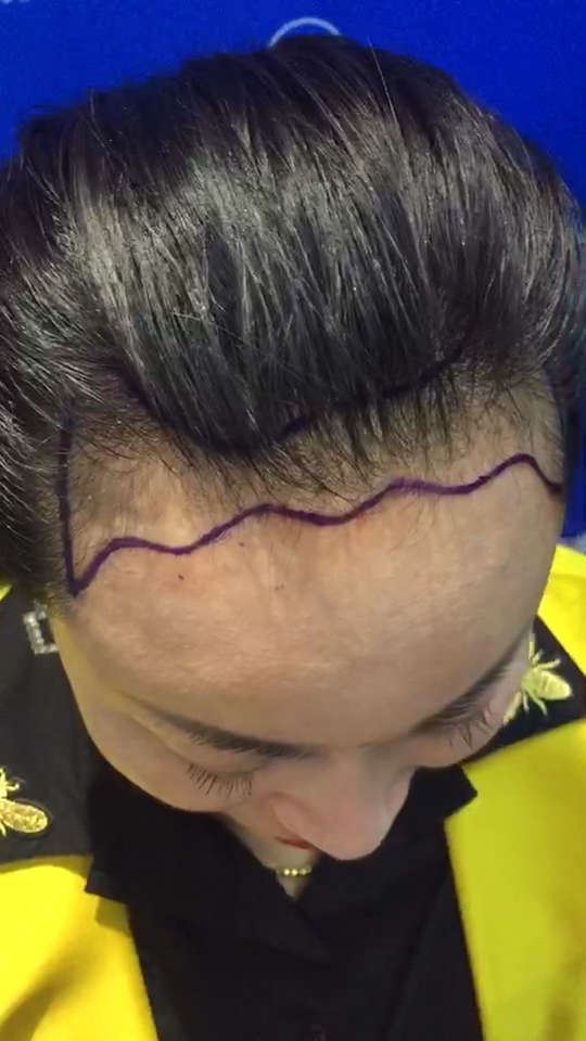 美哒哒的花瓣形发际线