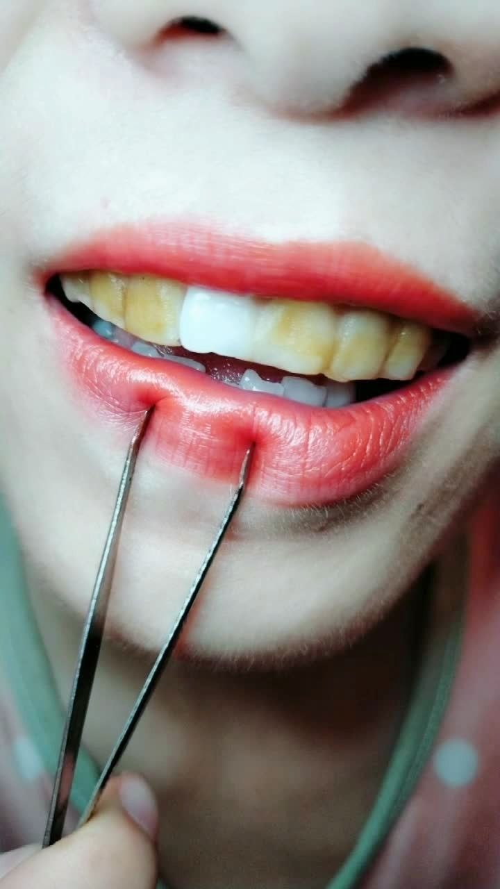 白牙小妙招轻松变白牙,拥有自信笑容