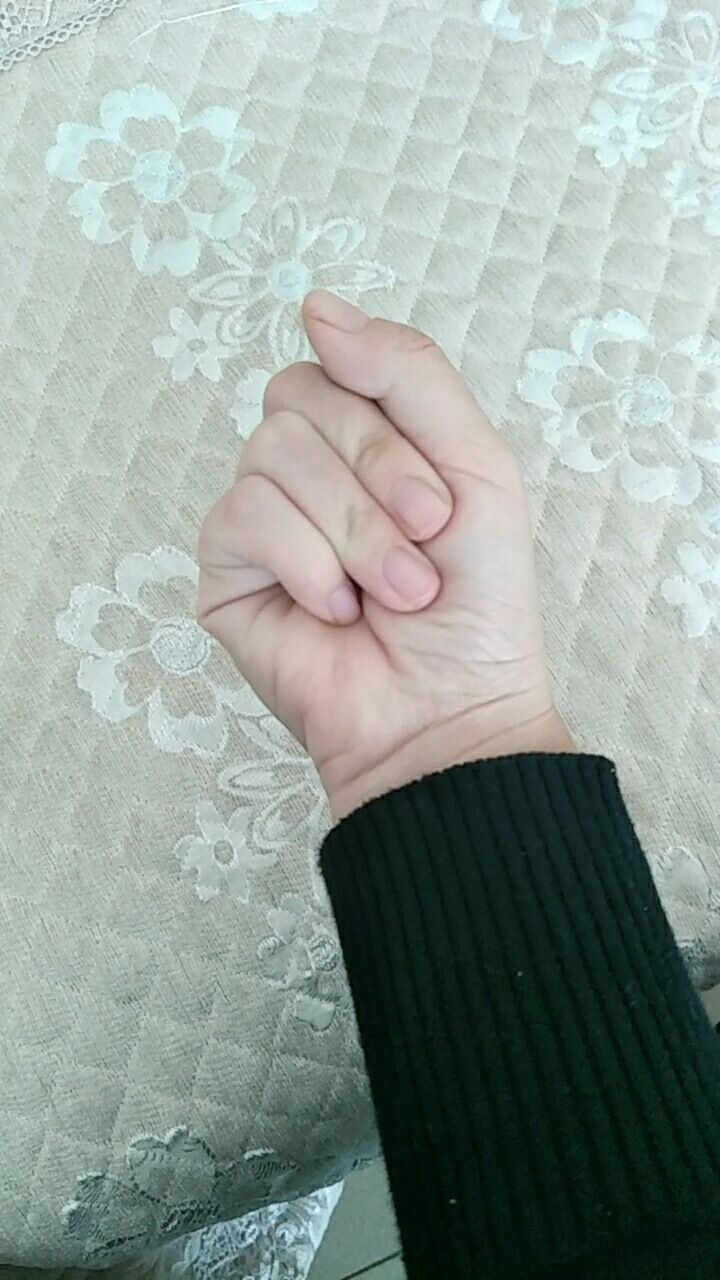 今天才发现我怎么有4根手指0505050505,你们有吗,你们有吗