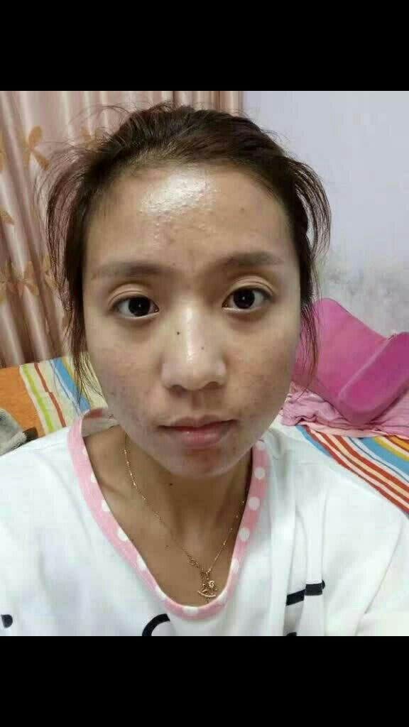 还在为自己脸暗黄粗糙毛孔粗大而烦恼吗?李氏明心帮你来解决