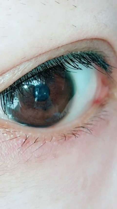 我二只眼睛的对比