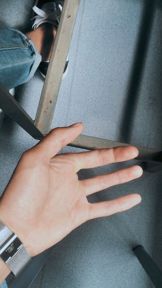 天生四手根指的我,但丝毫没有影响我浪啊